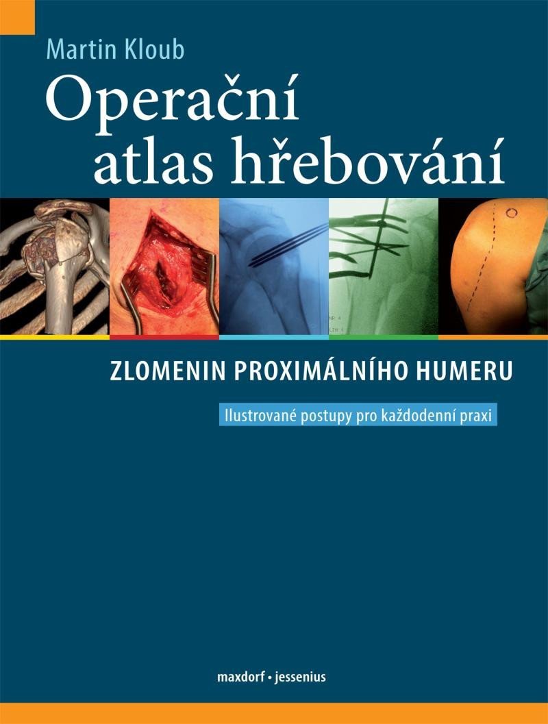 Operační atlas hřebování zlomenin proximálního humeru – Kloub Martin
