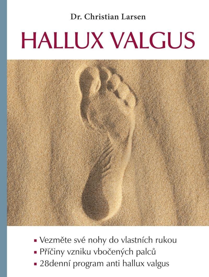 Hallux valgus – Larsen Christian