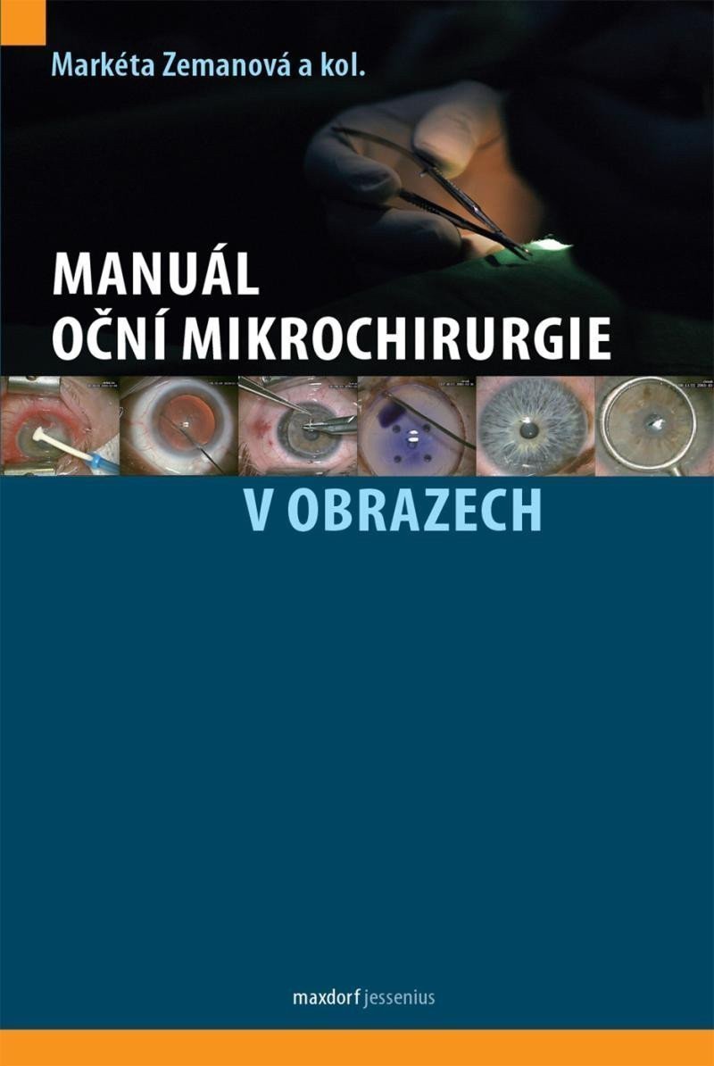 Manuál oční mikrochirurgie v obrazech – Zemanová Markéta