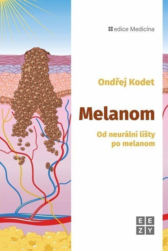 Melanom - Od neurální lišty po melanom – Kodet Ondřej