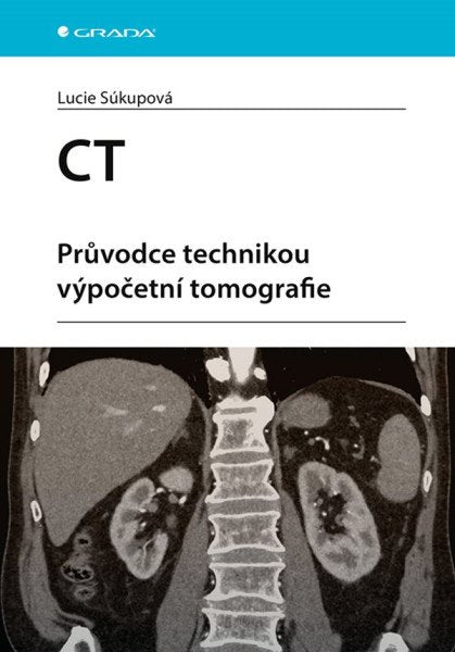 CT - Průvodce technikou výpočetní tomografie – Súkupová Lucie (2024)