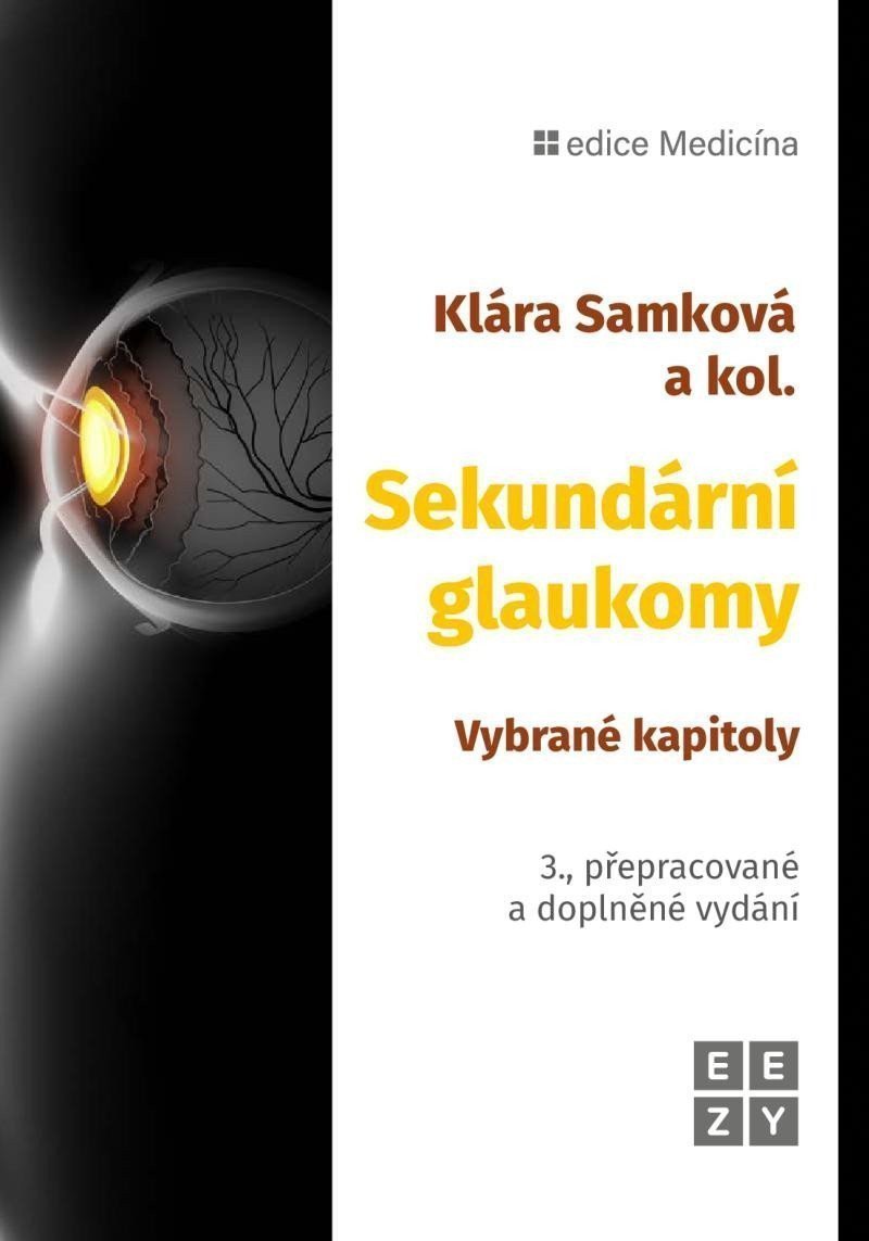 Sekundární glaukomy - Vybrané kapitoly – Samková Klára