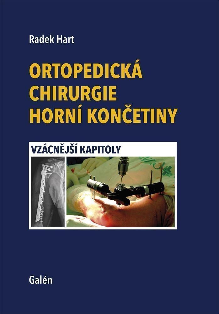 Ortopedická chirurgie horní končetiny - Vzácnější kapitoly – Hart Radek
