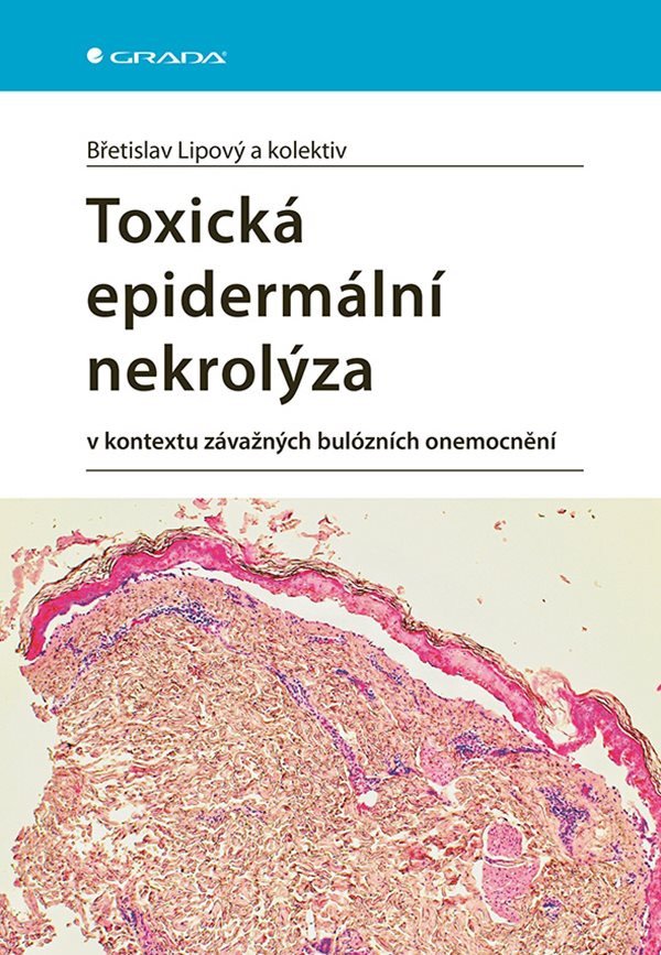 Toxická epidermální nekrolýza v kontextu závažných bulózních onemocnění – Lipový Břetislav