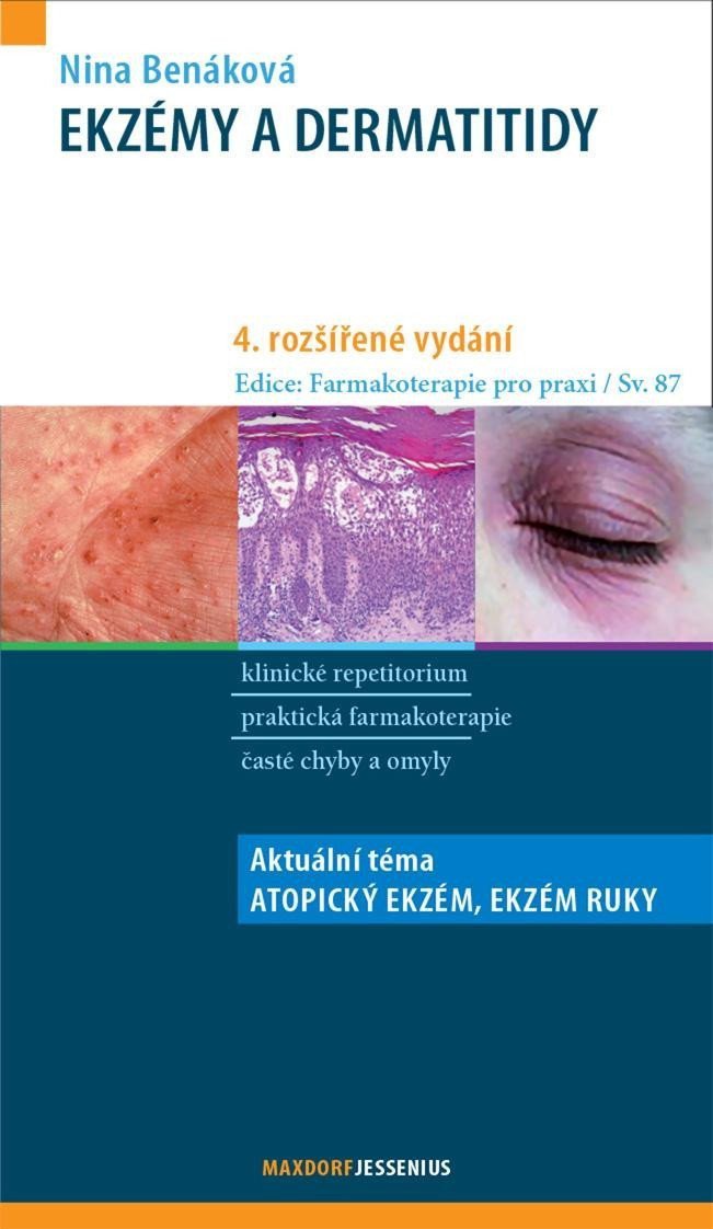 Ekzémy a dermatitidy – Benáková Nina