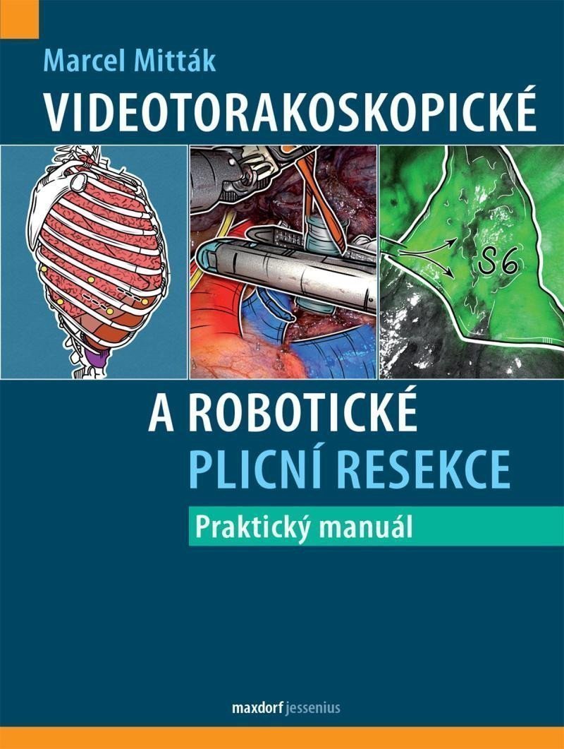 Videotorakoskopické a robotické plicní resekce – Mitták Marcel