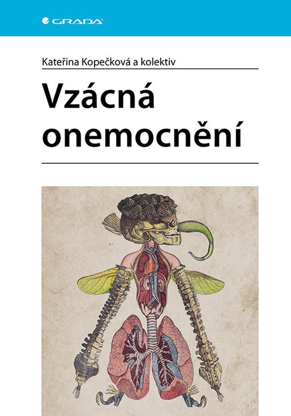 Vzácná onemocnění – Kopečková Kateřina