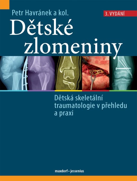 Dětské zlomeniny - Dětská skeletální traumatologie v přehledu a praxi (2026)